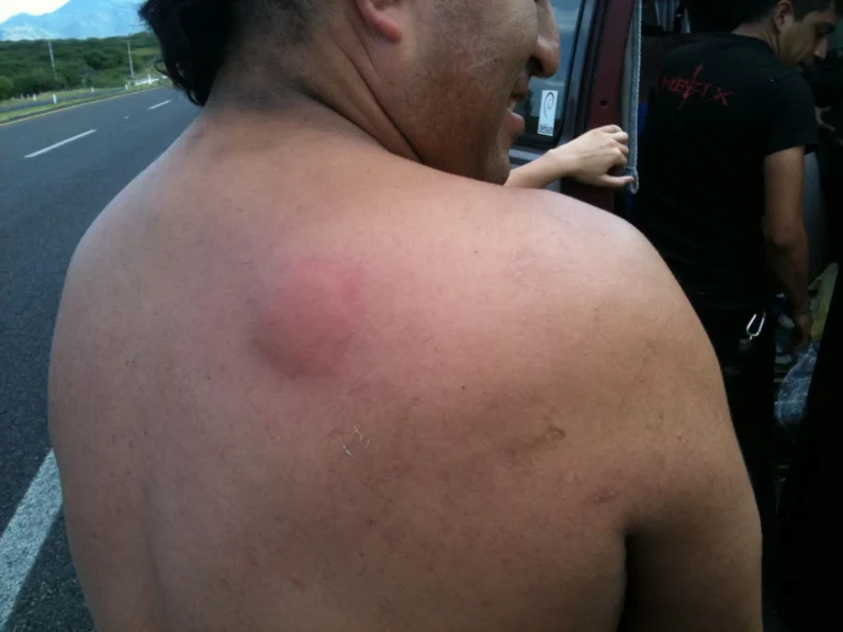 Rattus – Gira Mexico 2010, photo 19
